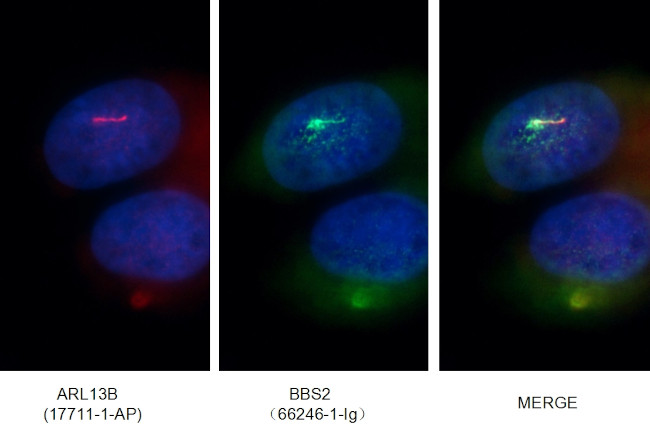BBS2 Antibody in Immunocytochemistry (ICC/IF)