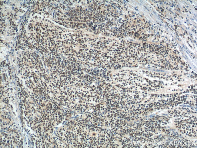 PHOX2B Antibody in Immunohistochemistry (Paraffin) (IHC (P))