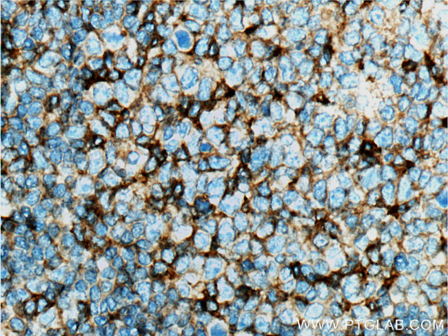 CD11a/Integrin alpha-L Antibody in Immunohistochemistry (Paraffin) (IHC (P))