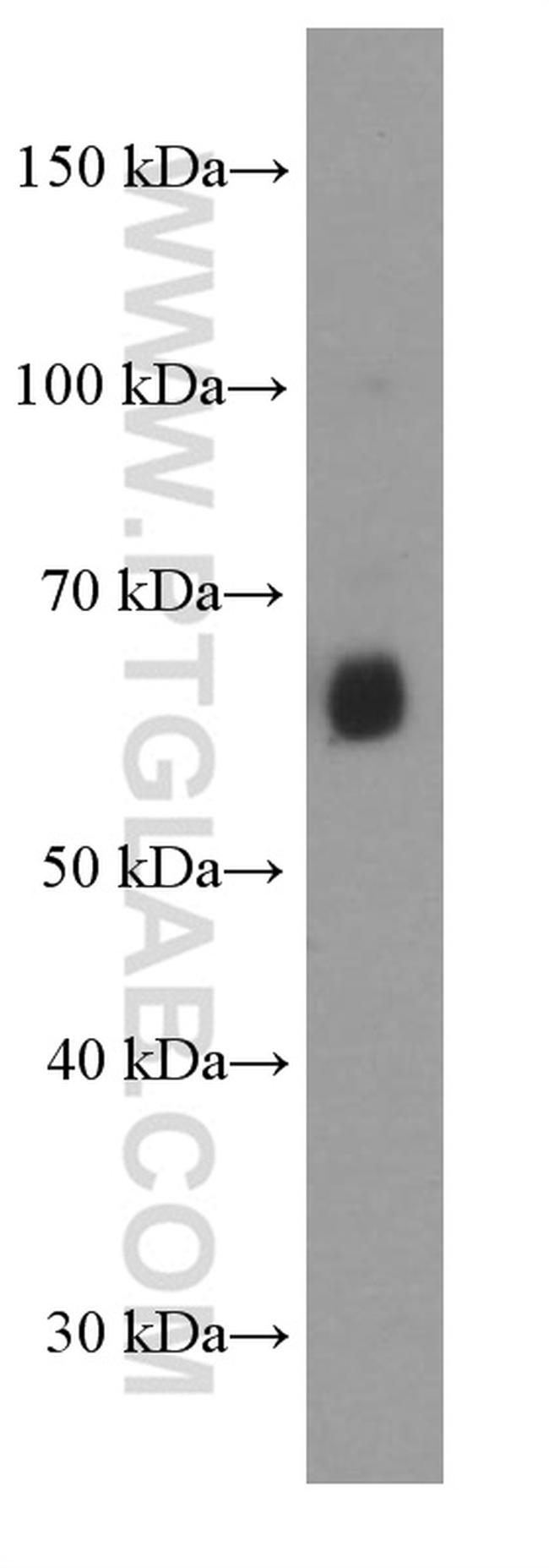 AIRE Antibody in Western Blot (WB)