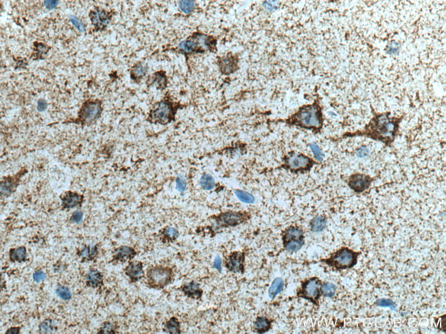 KGA Antibody in Immunohistochemistry (Paraffin) (IHC (P))