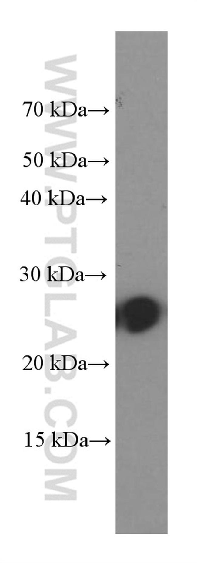 C1qC Antibody in Western Blot (WB)