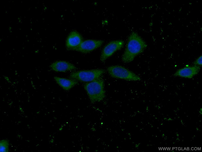 CLTB Antibody in Immunocytochemistry (ICC/IF)
