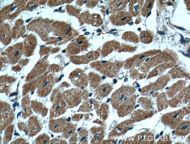 CLPP Antibody in Immunohistochemistry (Paraffin) (IHC (P))