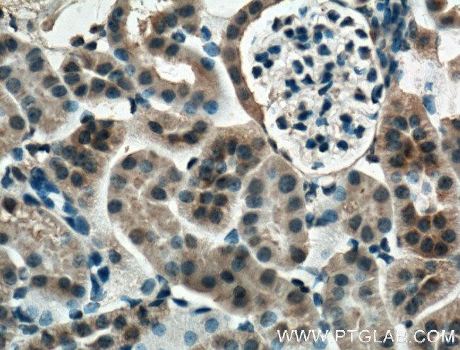 Mcp1 Antibody in Immunohistochemistry (Paraffin) (IHC (P))