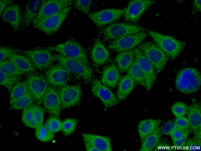 CLTCL1 Antibody in Immunocytochemistry (ICC/IF)