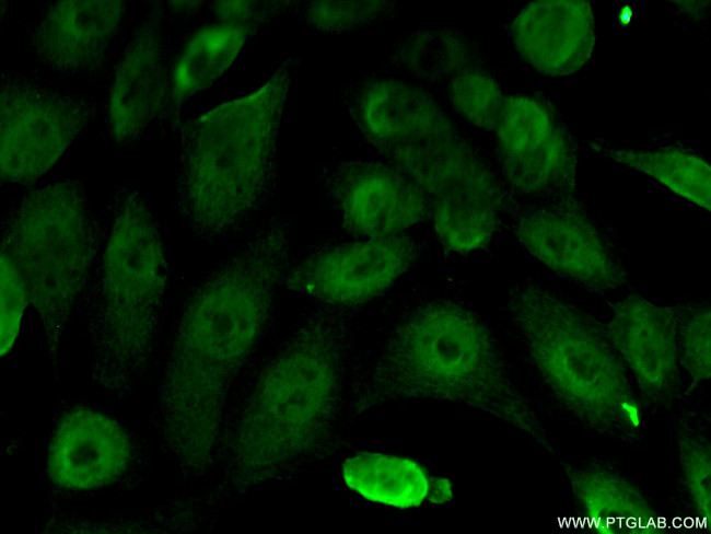 ERCC1 Antibody in Immunocytochemistry (ICC/IF)