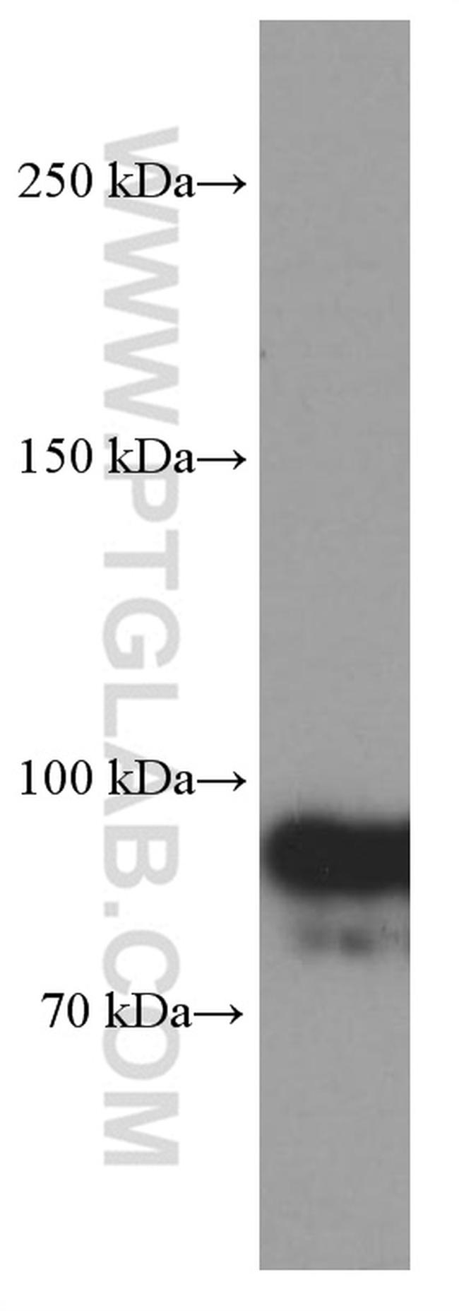 OTUD7B Antibody in Western Blot (WB)