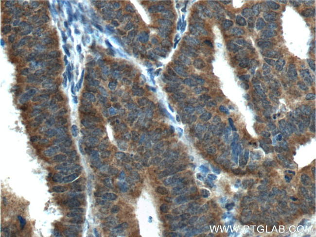 IGF1R beta chain Antibody in Immunohistochemistry (Paraffin) (IHC (P))