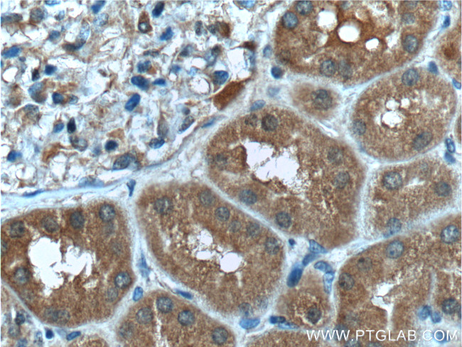 SDCCAG8 Antibody in Immunohistochemistry (Paraffin) (IHC (P))
