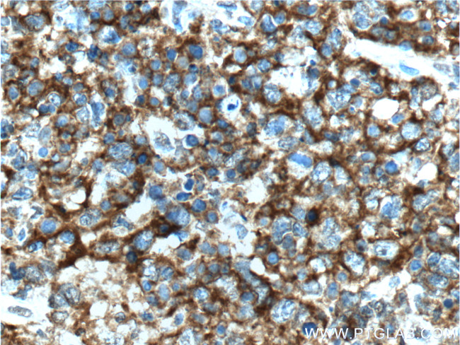 CD19 Antibody in Immunohistochemistry (Paraffin) (IHC (P))