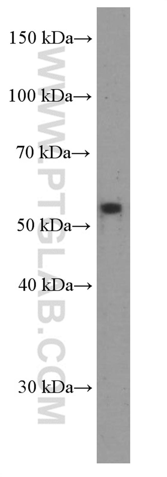 RXRG Antibody in Western Blot (WB)
