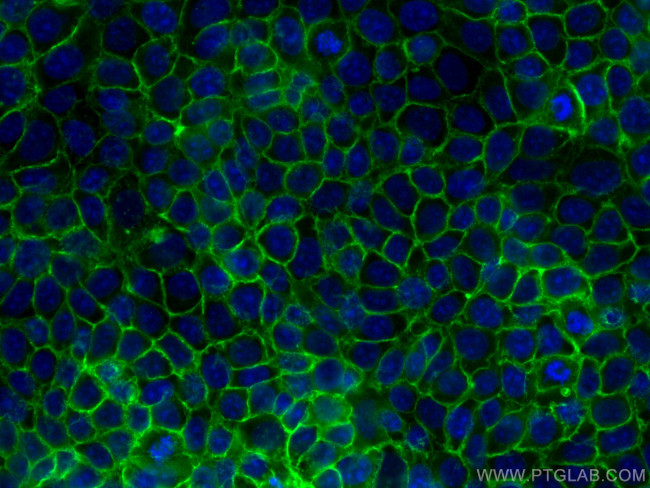 EPCAM Antibody in Immunocytochemistry (ICC/IF)