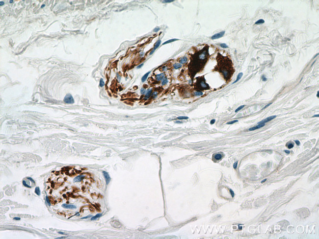 Peripherin Antibody in Immunohistochemistry (Paraffin) (IHC (P))
