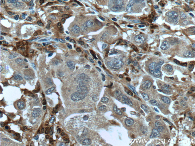 Factor XIIIa Antibody in Immunohistochemistry (Paraffin) (IHC (P))