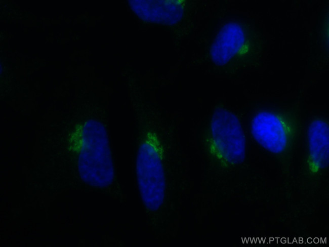 GP73/GOLPH2 Antibody in Immunocytochemistry (ICC/IF)