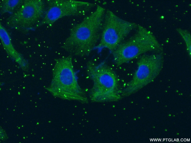 TH Antibody in Immunocytochemistry (ICC/IF)