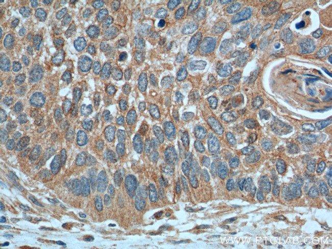CRBN Antibody in Immunohistochemistry (Paraffin) (IHC (P))