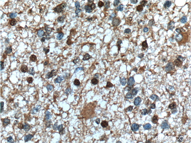 PHF10 Antibody in Immunohistochemistry (Paraffin) (IHC (P))