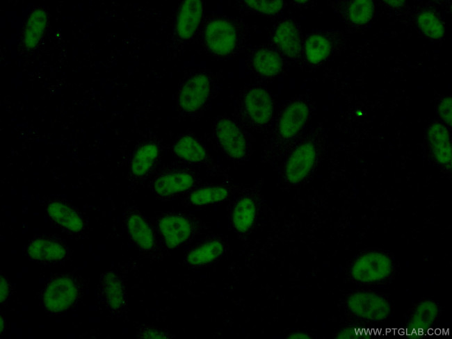 MKP-2 Antibody in Immunocytochemistry (ICC/IF)