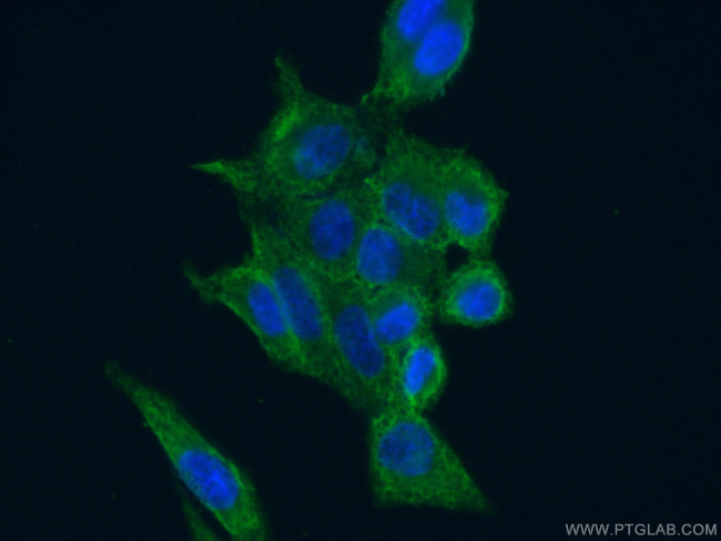 CAPRIN1 Antibody in Immunocytochemistry (ICC/IF)