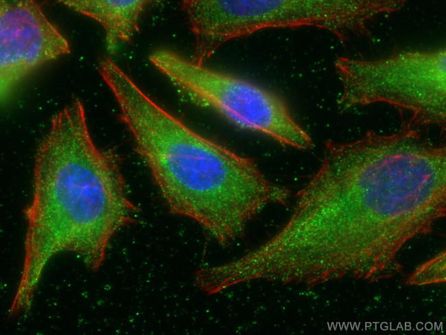 POMC Antibody in Immunocytochemistry (ICC/IF)