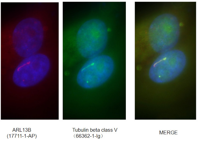 Tubulin beta class V Antibody in Immunocytochemistry (ICC/IF)