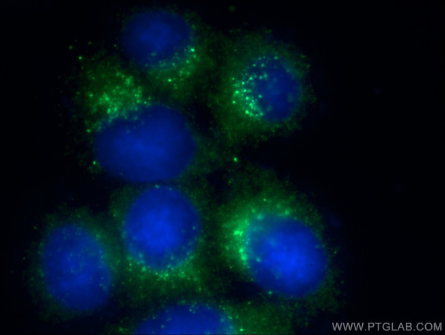 ERp72 Antibody in Immunocytochemistry (ICC/IF)