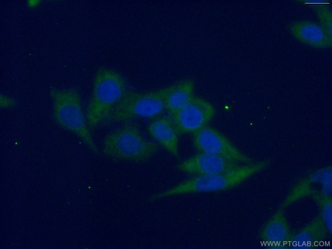 G6PD Antibody in Immunocytochemistry (ICC/IF)