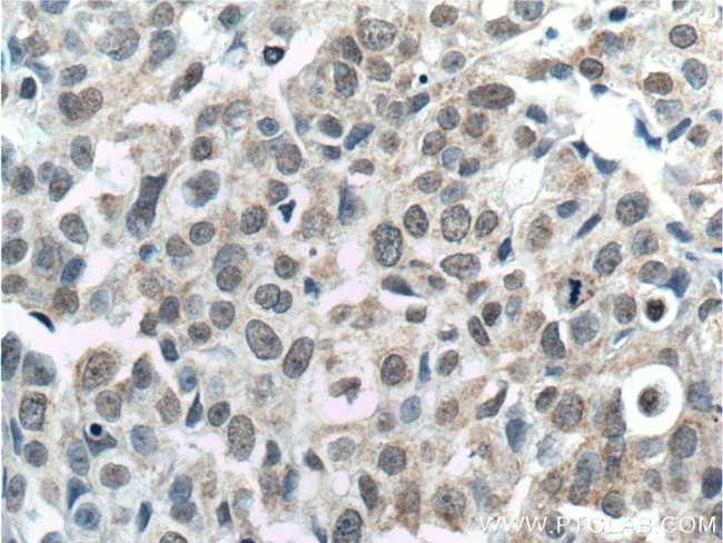 TINP1 Antibody in Immunohistochemistry (Paraffin) (IHC (P))