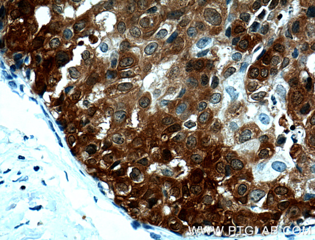 PADI2 Antibody in Immunohistochemistry (Paraffin) (IHC (P))