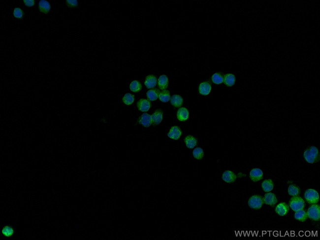 CD74 Antibody in Immunocytochemistry (ICC/IF)