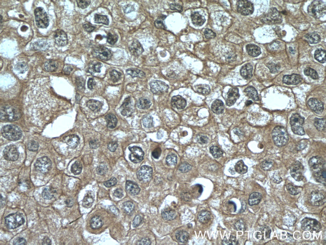VPRBP Antibody in Immunohistochemistry (Paraffin) (IHC (P))
