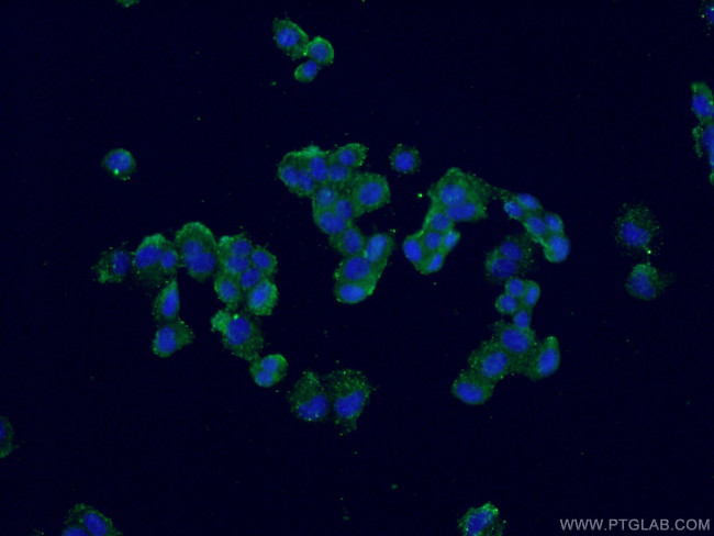 Calbindin-D28k Antibody in Immunocytochemistry (ICC/IF)