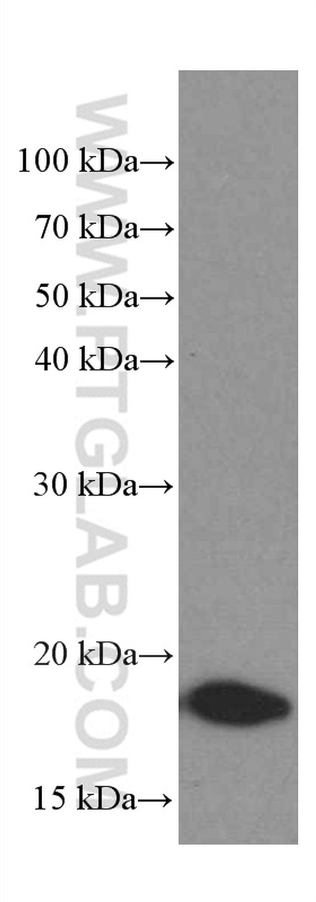 TPRKB Antibody in Western Blot (WB)