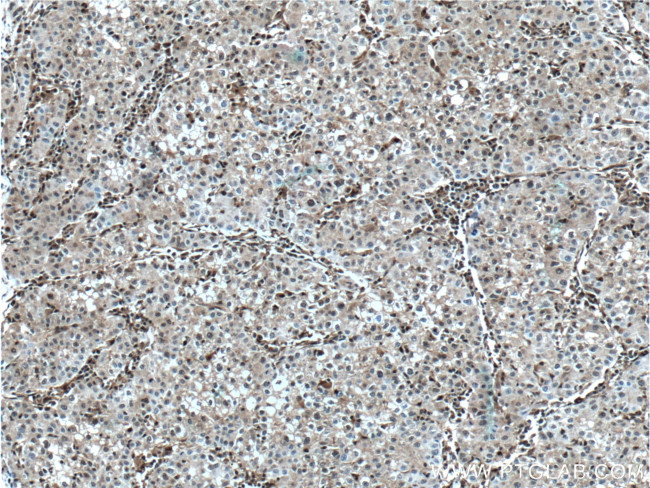 PSMB10 Antibody in Immunohistochemistry (Paraffin) (IHC (P))