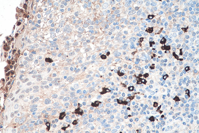 Heavy chain of IgG4 Antibody in Immunohistochemistry (Paraffin) (IHC (P))