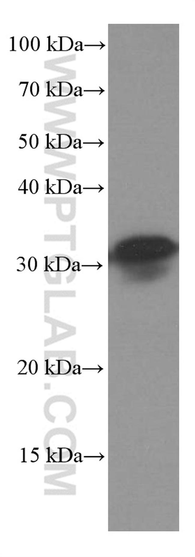 SCP3 Antibody in Western Blot (WB)