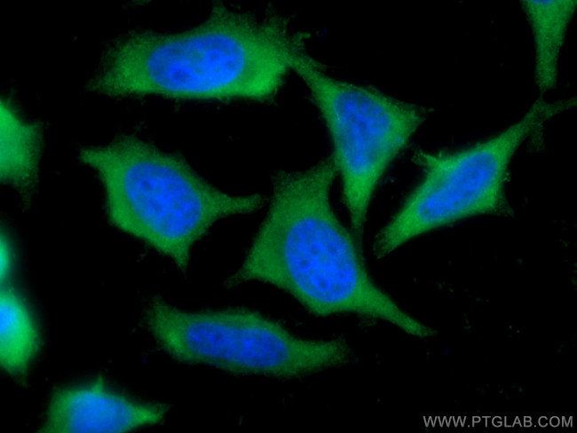 LDHB Antibody in Immunocytochemistry (ICC/IF)