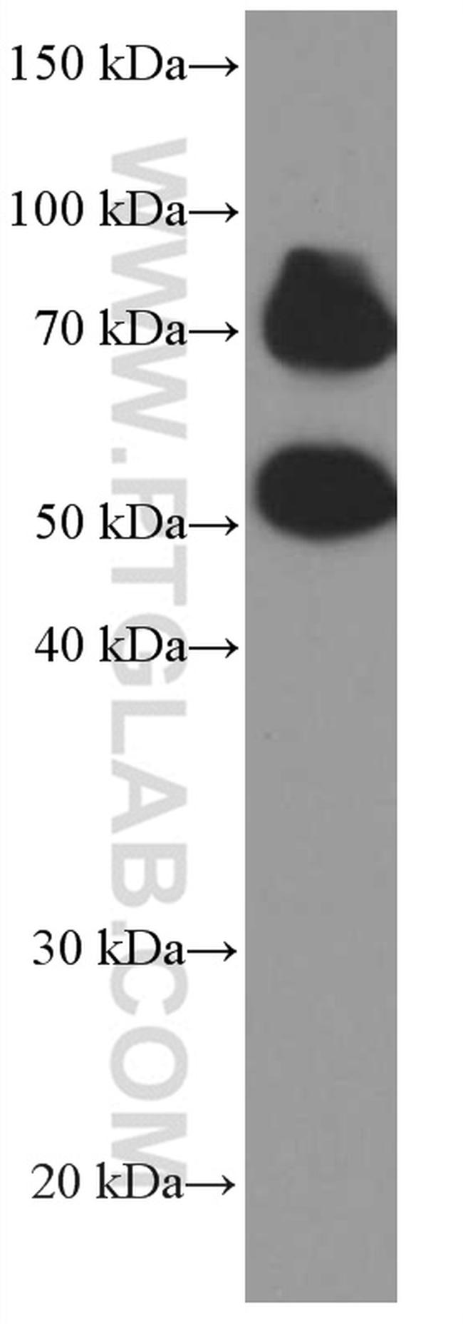 P2RX5 Antibody in Western Blot (WB)