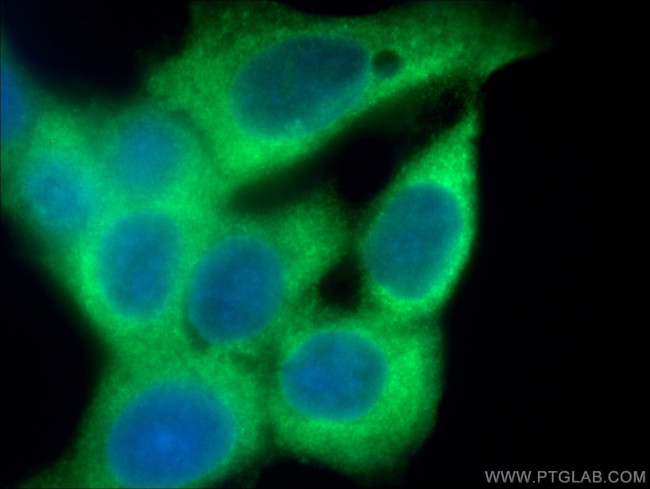 GDI1 Antibody in Immunocytochemistry (ICC/IF)