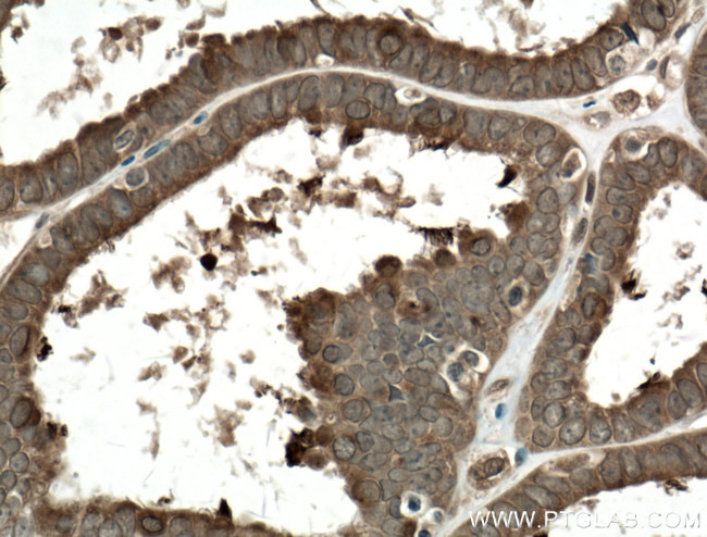 COPS2 Antibody in Immunohistochemistry (Paraffin) (IHC (P))