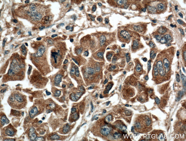 GNPAT Antibody in Immunohistochemistry (Paraffin) (IHC (P))