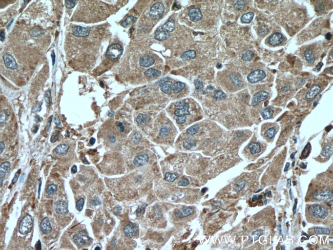 SERPINA7 Antibody in Immunohistochemistry (Paraffin) (IHC (P))