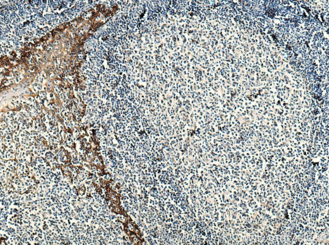 EGFR Antibody in Immunohistochemistry (Paraffin) (IHC (P))