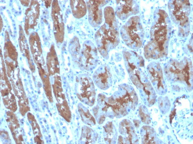 Superoxide Dismutase 1 (SOD1) (Antioxidant Enzyme) Antibody in Immunohistochemistry (Paraffin) (IHC (P))