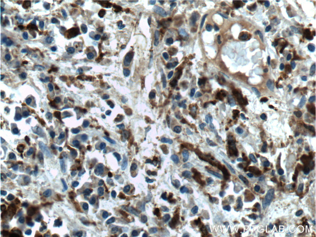 PSAP Antibody in Immunohistochemistry (Paraffin) (IHC (P))