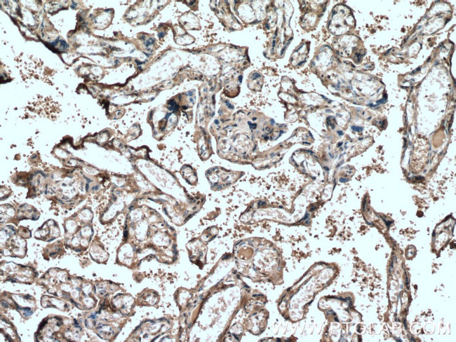 Hemopexin Antibody in Immunohistochemistry (Paraffin) (IHC (P))