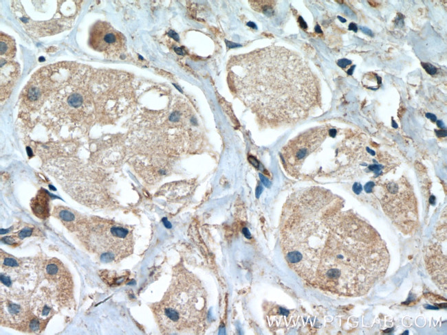 STAT2 Antibody in Immunohistochemistry (Paraffin) (IHC (P))