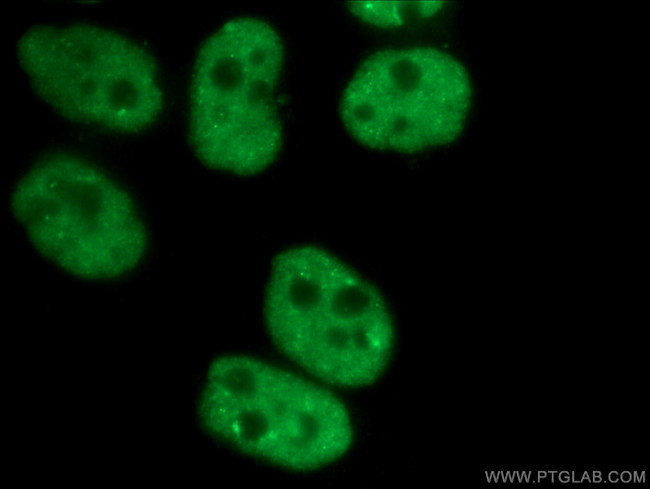CCAR2 Antibody in Immunocytochemistry (ICC/IF)